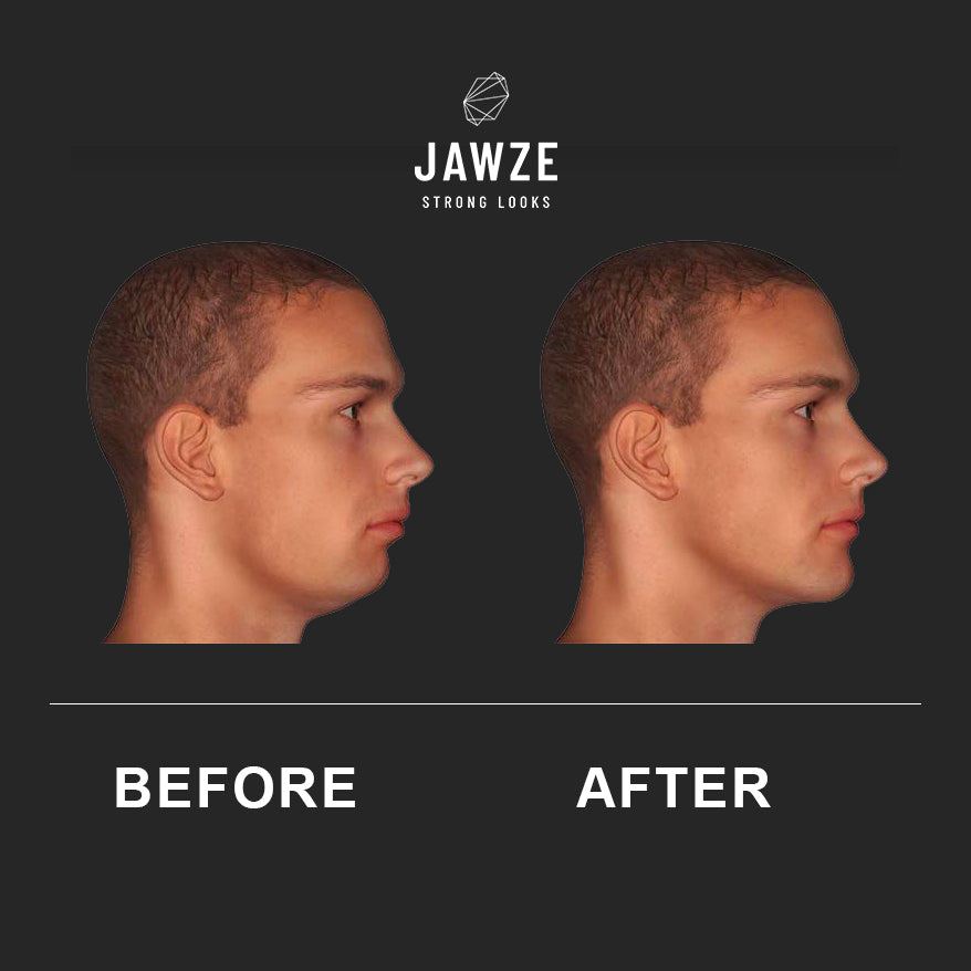Jaw Trainer Starting Kit - 3 Levels